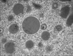 Forschende der Universitätsmedizin Mainz haben einen auf nicht-infektiösen Partikeln basierenden Impfstoff gegen das Cytomegalovirus entwickelt. Das Bild zeigt eine mikroskopische Aufnahme dieser kugelförmigen Partikel.